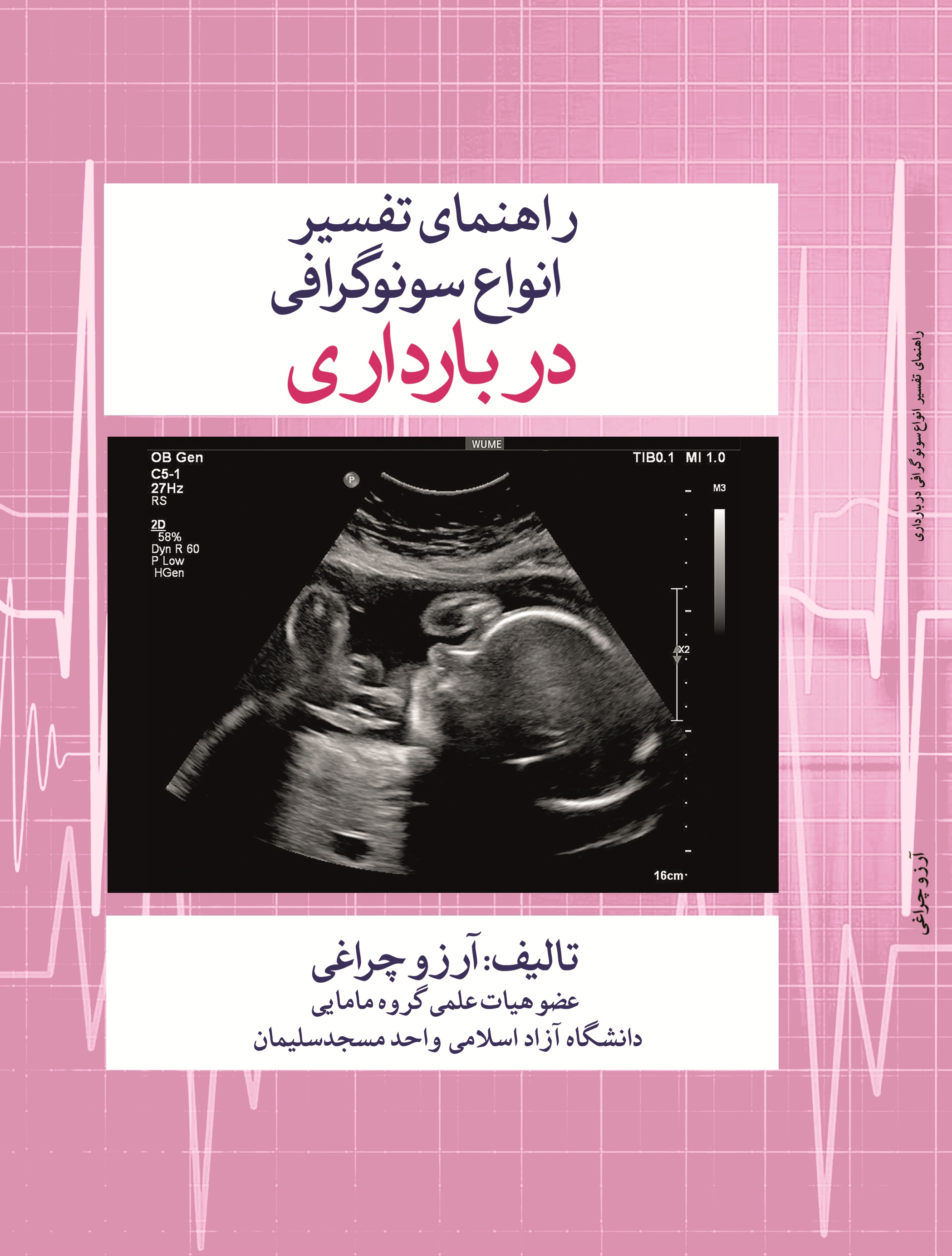 راهنمای تفسیر انواع سونوگرافی در بارداری